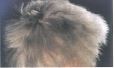 SINDROME DEL CABELLO IMPEINABLE