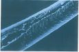 TRICOPTILOSIS